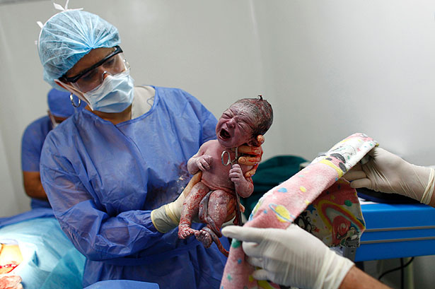 Cerca de 10% das crianças precisam de auxílio para respirar após o parto, alerta o presidente da Sociedade Brasileira de Pediatria